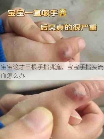 宝宝这才三根手指就流，宝宝手指头流血怎么办