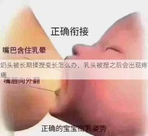 奶头被长期揉捏变长怎么办，乳头被捏之后会出现疼痛