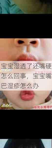 宝宝湿透了还嘴硬怎么回事，宝宝嘴巴湿疹怎么办  第1张