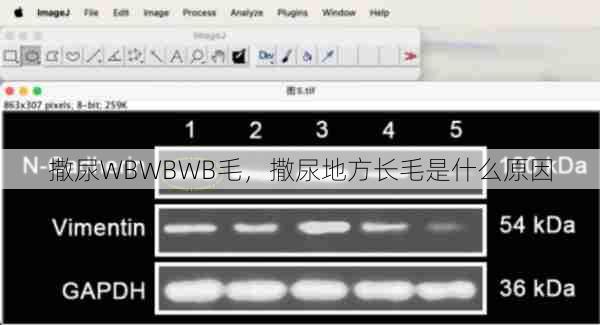 撒尿WBWBWB毛，撒尿地方长毛是什么原因  第1张